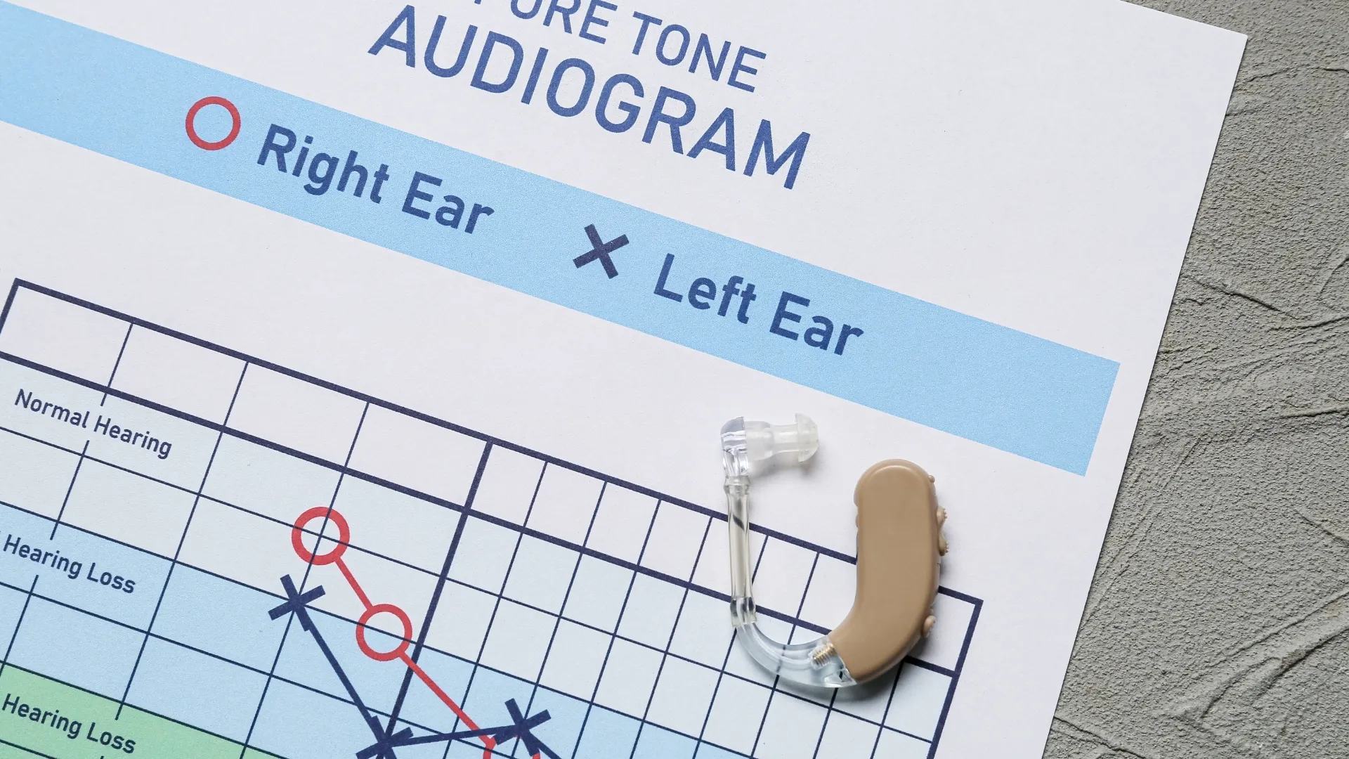 Featured image for “The Role of Extended High-Frequency Audiometry in Adult Diagnostics”